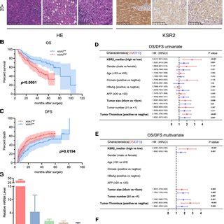 Elevated KRS2 Is Associated With Poor Prognosis A The Expression Of