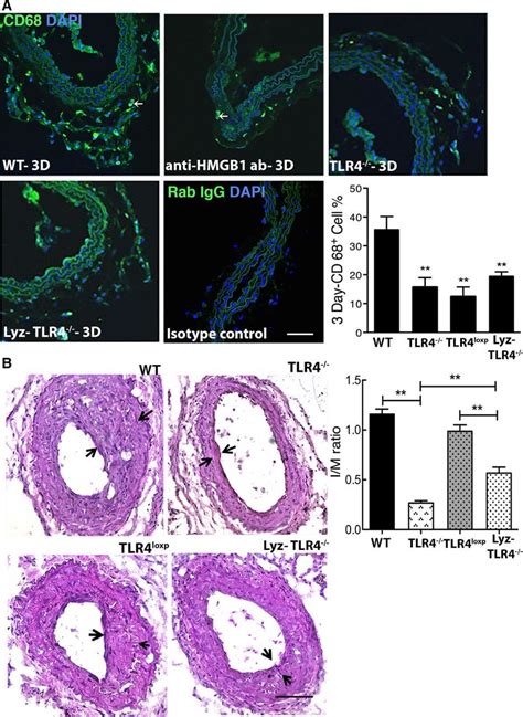 Hmgb1 Driven Inflammation And Intimal Hyperplasia After Arterial Injury