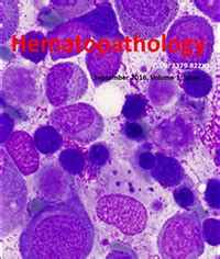 Abdul Nabi Cd Positive Dysplastic Giant Platelets Masquerading As