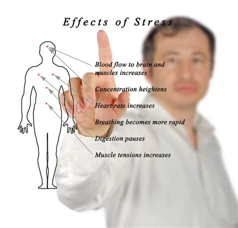 Diagram Of Complications Of Obesity Stock Photo By ©vaeenma 122767446
