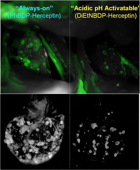 Frontiers Fluorescence Guided Surgery