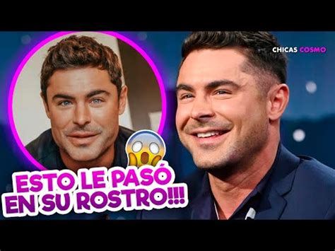 El Sorprendente Cambio En La Cara De Zac Efron Qu Le Ha Ocurrido Al