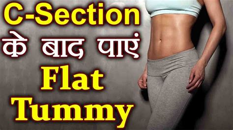 Weight Loss After Pregnancy C Section Flat