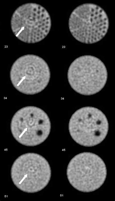 Extrinsic Versus Intrinsic Uniformity Correction For Cameras