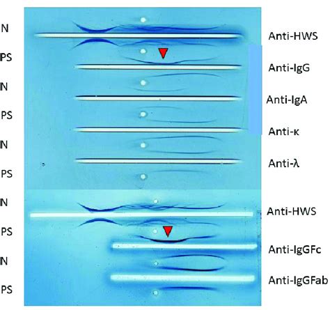 In Serum Immunoelectrophoresis Serum Formed An M Bow In Response To Download Scientific