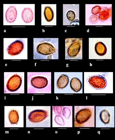 Spores of Ganoderma species (bar = 5 μm). a. Ganoderma applanatum; b ...