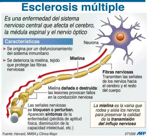 Esclerosis Múltiple ¿qué Es Sintomas Y Tratamientos Como Funciona Todo