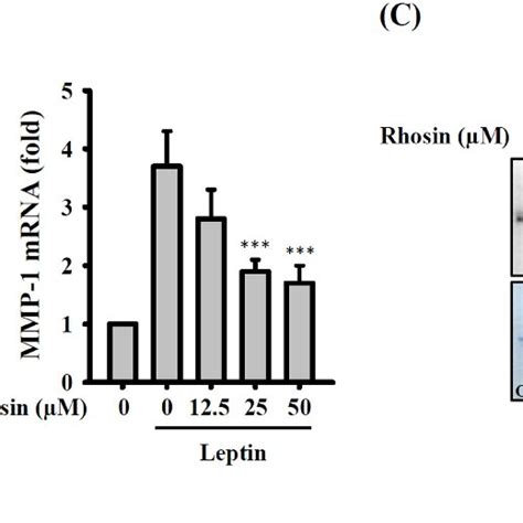 Effect Of Rhoa On Leptin Induced Mmp 1 Expression A Sv40 Cells Were