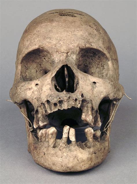 Human Skull With Mandible Skull Reference Real Human Skull Skull