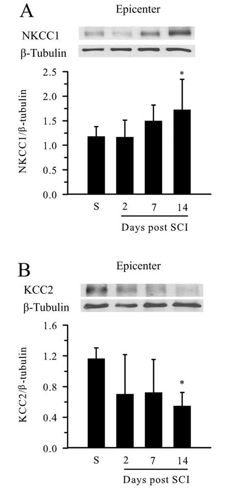 Early Changes In Expression Of Nkcc And Kcc Proteins In Epicenter