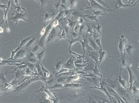 Caki 1 Cells