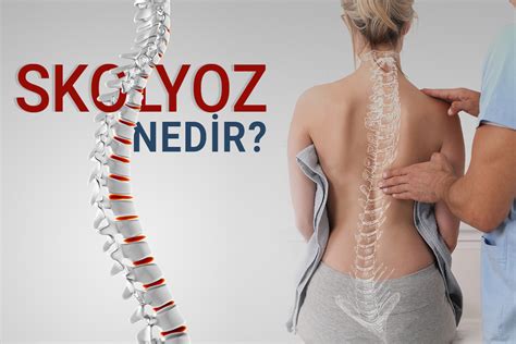 Skolyoz Nedir Tedavisi Ve Ameliyat Nas Ld R Turan Turan