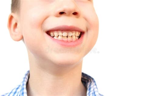 Boy, Kid Smiling with Open Mouth, Close Up of Childâ€™s Mouth, Teeth, Concept of Child Skin Care ...