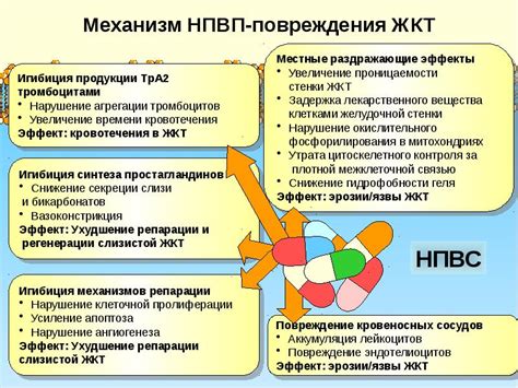 НПВС - презентация, доклад, проект скачать