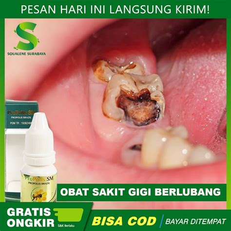 Jual Obat Sakit Gigi Berlubang Obat Gigi Bengkak Nyut Nyutan Obat