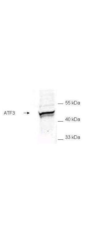 Ihc Plus™ Atf3 Polyclonal Antibody Rabbit Anti Human Lsbio