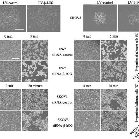 Hcg Regulates Ovarian Cancer Cell Morphology And Attachment Ability