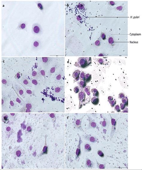 Giemsa Stain Preparation Procedure Principle Off