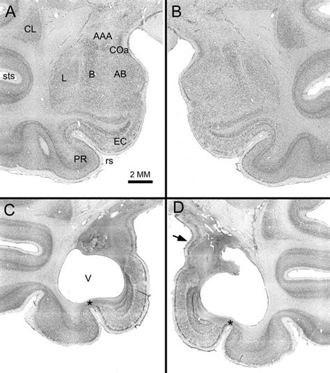 Higher-magnification photomicrographs of the left (A) and right (B ... 