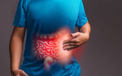 Síndrome del Intestino Irritable SII en Bogota Gastrocentro