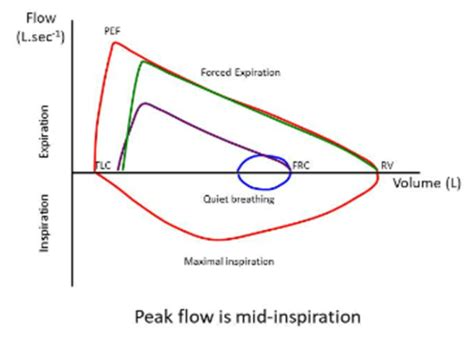 Flow Volume Loops Flashcards Quizlet