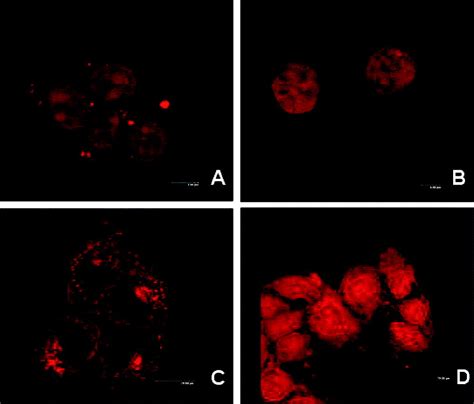 Reversal Of Doxorubicin Resistance In Breast Cancer Cells By