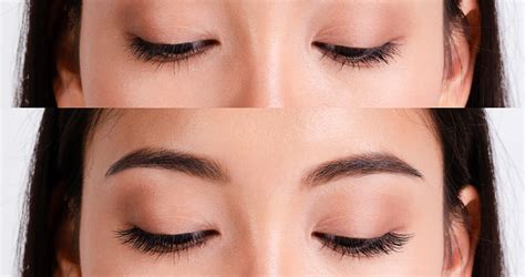 Your Complete Solution For Thicker Lashes Using Careprost Eyelash Serum