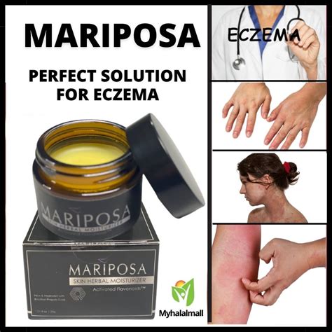 MARIPOSA Cream Ekzema Cream Gatal 30g Black Cap Krim Gatal Kuilt