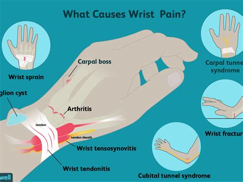 Shoulder Elbow And Wrist Pain Regenerative Medicine San Diego