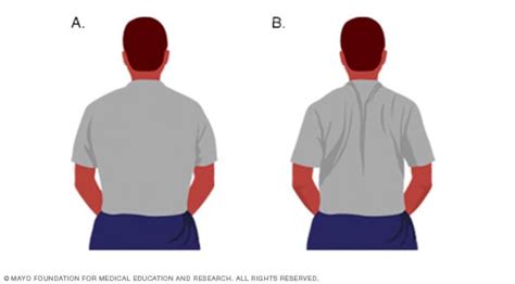 Ejercicios Para La Espalda Superior Care Guide Information En Espanol