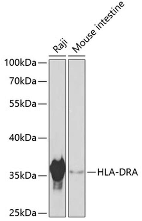 Hla Dra Polyclonal Antibody Pa5 88258