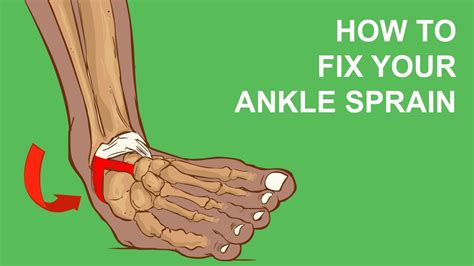 How To Fix Your Ankle Sprain Youtube