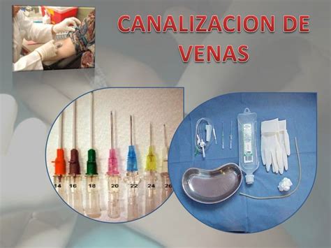 CANALIZACION DE VENAS