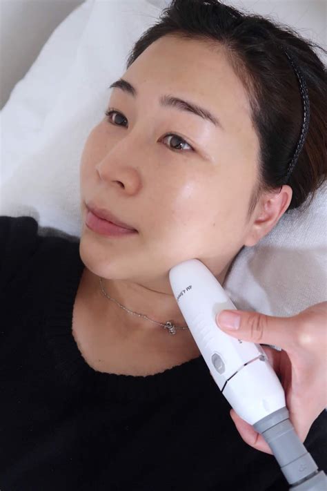 Makeup Secret 「無針埋線」同 Hifu 有咩分別「liftera Ultra V Lift」無針埋線緊緻瘦面效果