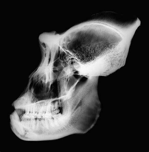 Gorilla Skull X Ray Photograph By D Roberts