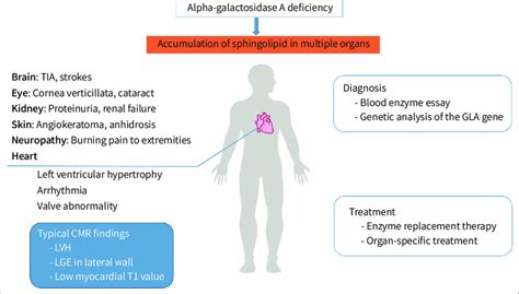 Fabry Disease Symptoms Causes Treatment Nord 53 Off