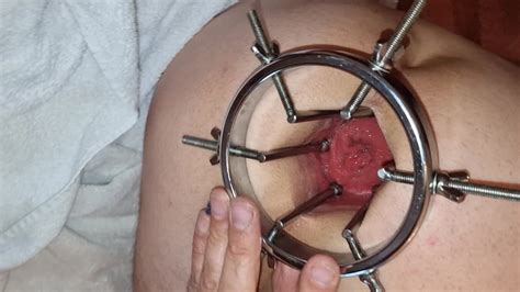 Deep View Into My Asshole My Ass Spreader 17 Nude Pics XHamster