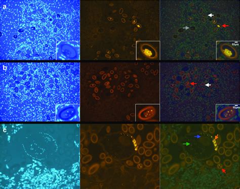 Fluorescent In Situ Hybridization Demonstrating The Presence Of Viral Download Scientific