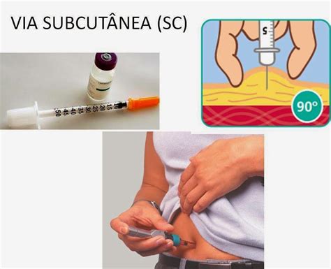 Administração Por Via Subcutânea Sc Enfermagem Bio