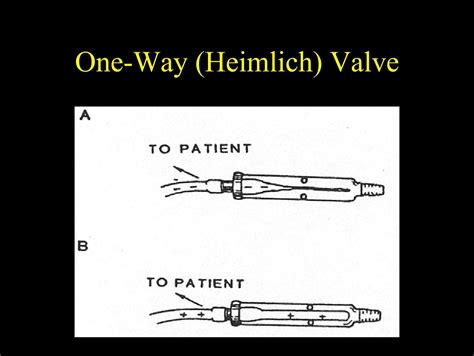 One Way Heimlich Valve