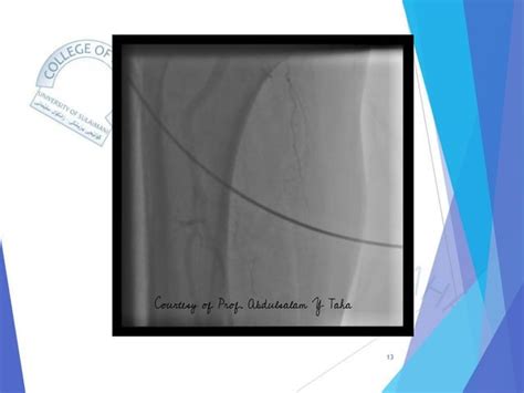 Suspected Aortofemoral Bypass Graft Thrombosis Pdf