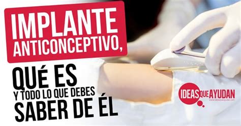 Implante Anticonceptivo Qu Es Y Todo Lo Que Debes Saber De L Iqa