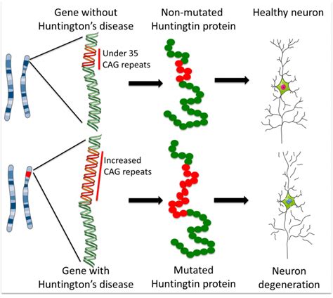 Huntingtons Disease How Could Stem Cells Help Eurostemcell