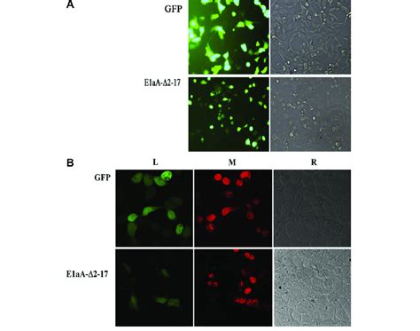 The Subcellular Localization Of Gfp E1aa D2 17 In Cos7 Cells Cos7