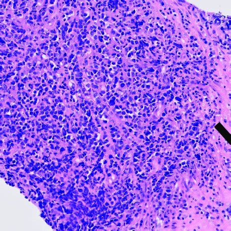 Histological Image Hematoxylin And Eosin Staining Enlargement 200x