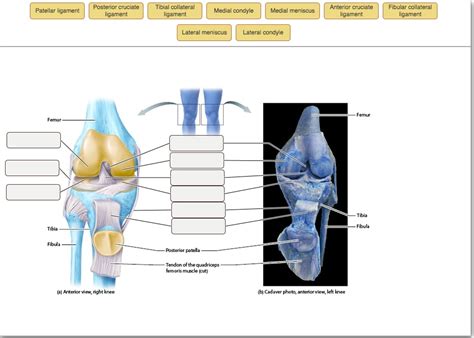 Solved Anatomical Structure Of The Knee Joint 1 Of 2 Patellar Ligament Posterior Cruciate