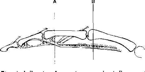 Figure From Clinical Aspects Of Flexor Tendon Healing Semantic Scholar