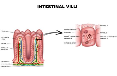 Whipple’s Disease : Overview, Causes, Symptoms, Treatment - illness.com