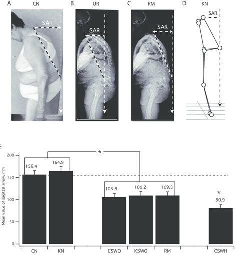 C7 Sagittal Arrow C7 SAR Measurement Under Various Methods And