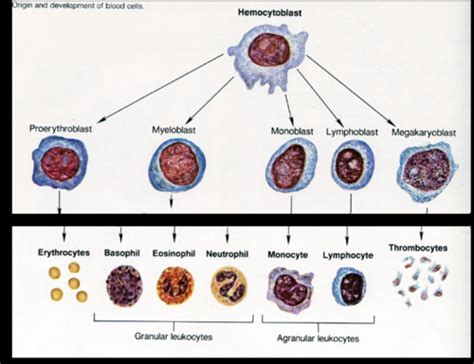 Pathology Lecture Inflammation Flashcards Quizlet